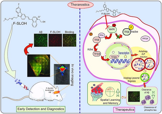 Early identification of Alzheimer's disease in mouse models